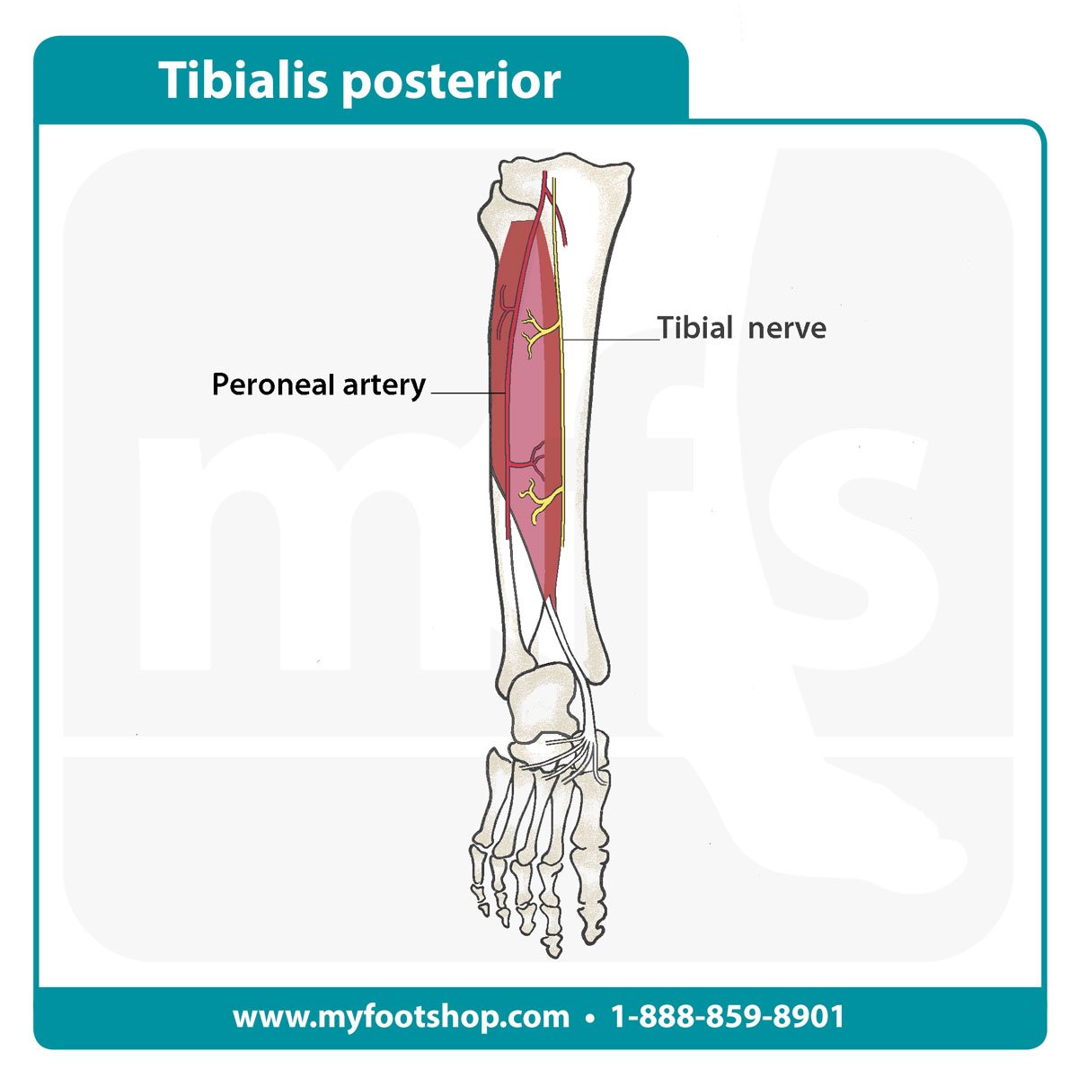Image of the tibialis posterior muscle and tendon