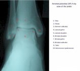 X-ray ankle anatomy