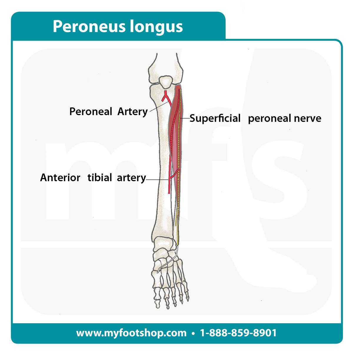 Image of the peroneus longus muscle and tendon