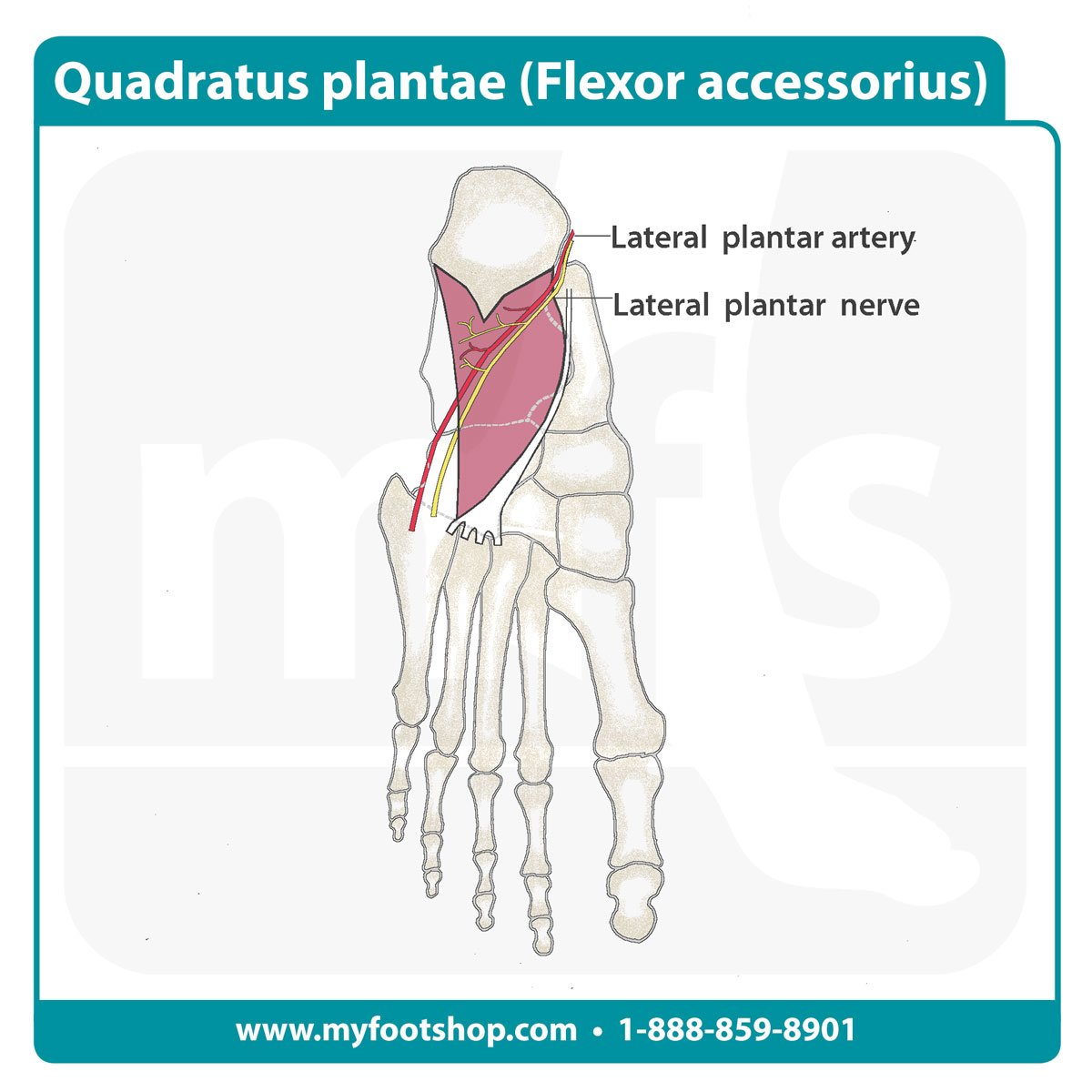Image of the quadratus plantae muscle of the foot