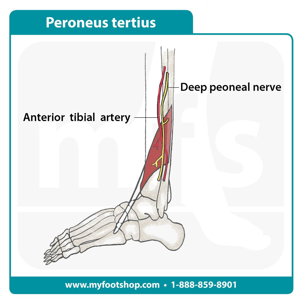 Peroneus tertius muscle