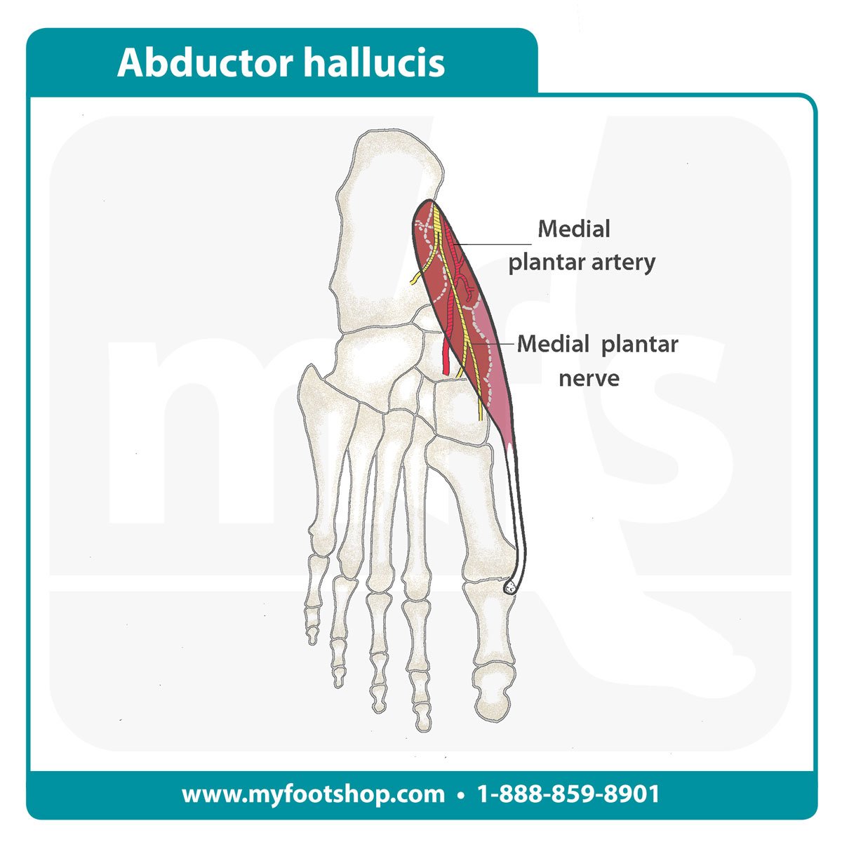 image of the abductor hallucis muscle of the foot