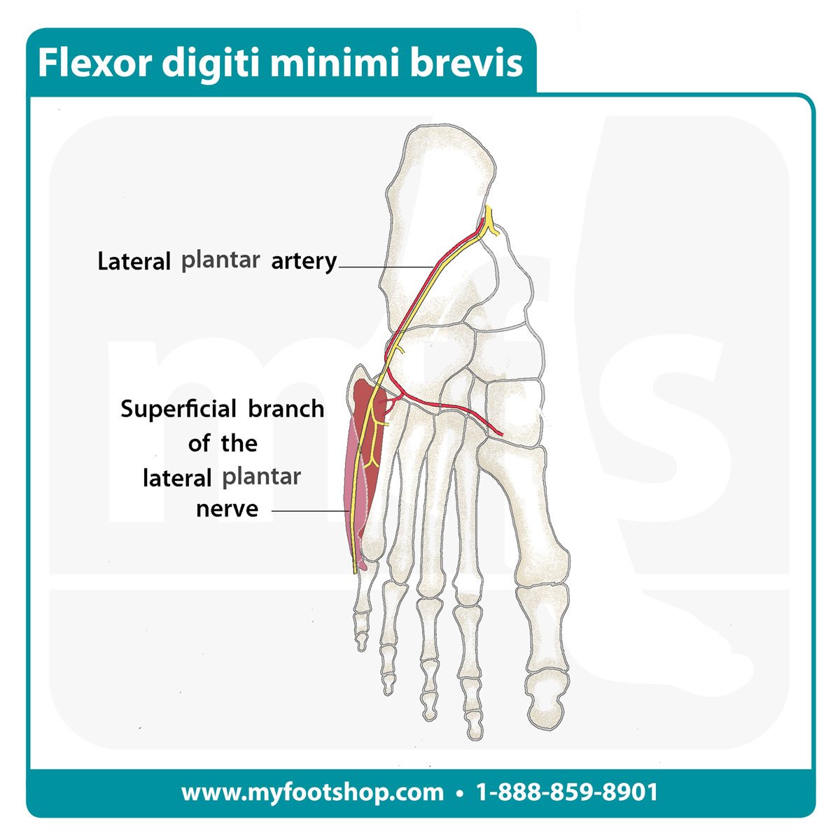 Image of the flexor digiti minimi brevis muscle