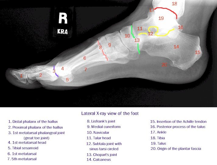 x-ray foot, lateral view