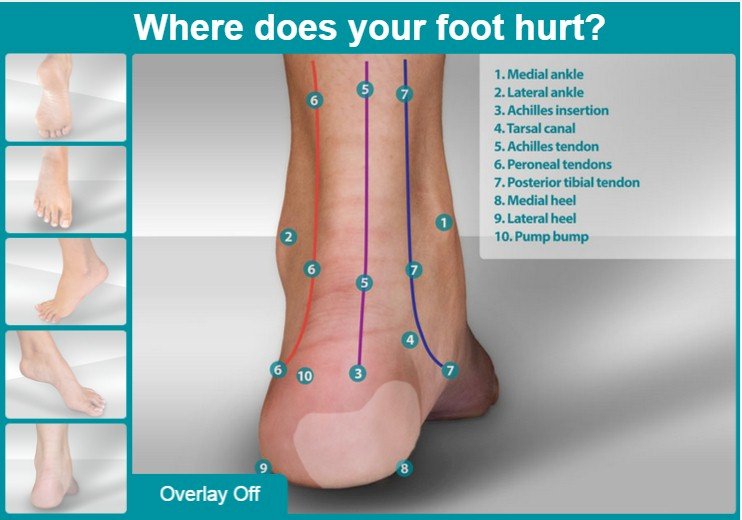 Foot pain finder | MyFootShop.com