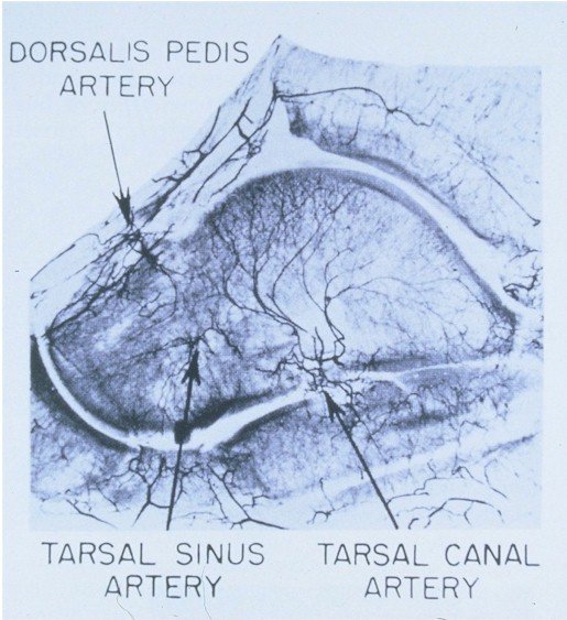Arterial in-flow of the talus