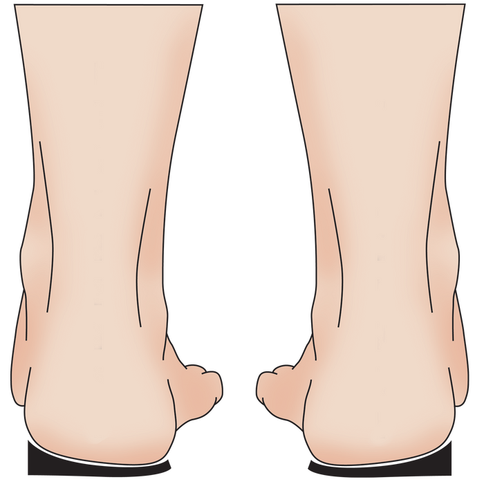 1/4" Thick Lateral Sole Wedge Inserts