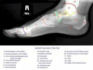 x-ray_foot