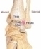 Picture of Ankle Pain