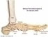 Picture of Bone Medial Mod - Labeled