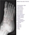 Picture of X-ray of the Foot - Oblique View