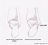 Picture of Lateral Ankle Positions - Posterior View