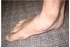 Picture of Pronation