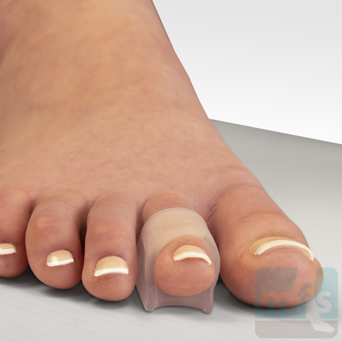 Hammer Toe: Causes, Symptoms, and Diagnosis