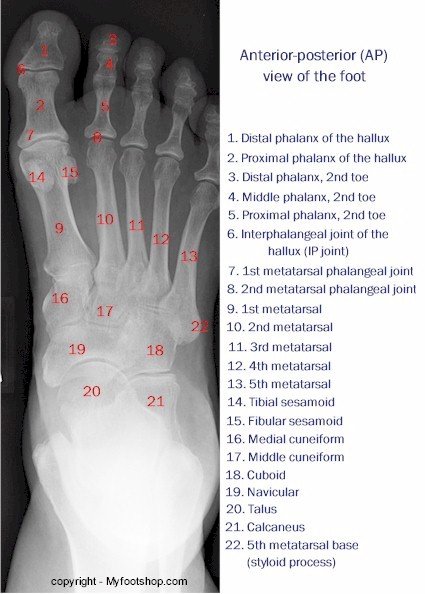 X-ray of the Foot - Anterior-Posterior View