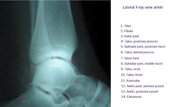 X-ray of the Ankle - Lateral View