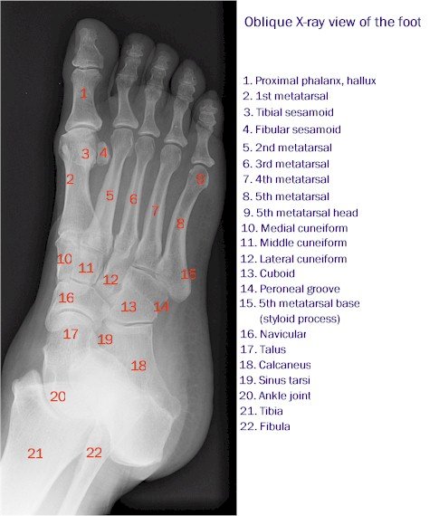 X-ray of the Foot - Oblique View