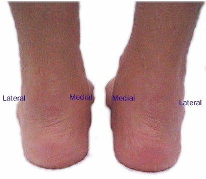 Posterior Foot Mod - Labeled